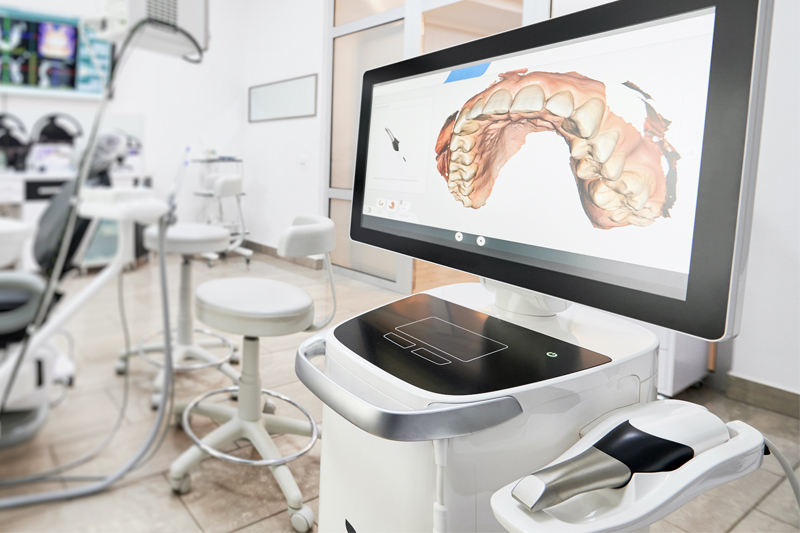 Intra-Oral Scanner in Fredericksburg